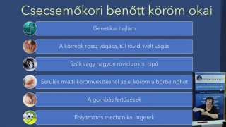 4. Gyermekkori benőtt köröm