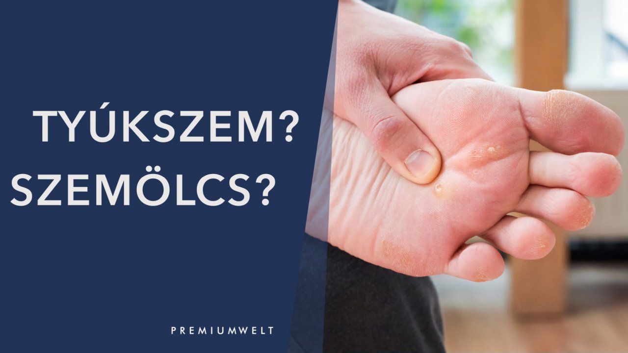 Tyúkszem? Szemölcs?