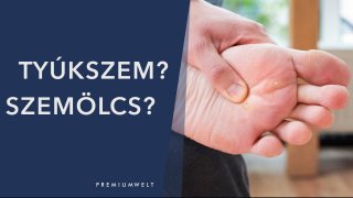 Tyúkszem? Szemölcs?