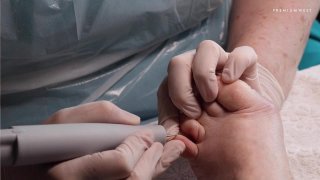 Bemutató kezelés, 2. modell, bal