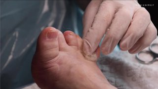 Bemutató kezelés, 2. modell, biogyapjú használat