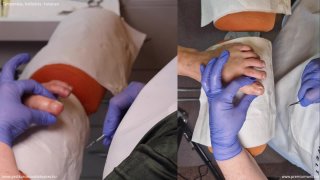 Bemutató kezelés 3. rész