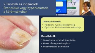 Előadás 2. rész